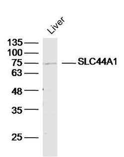 SLC44A1/CD92 Rabbit anti-Human, Polyclonal, Bioss 100 &mu;L; Unconjugated:Antibodies,