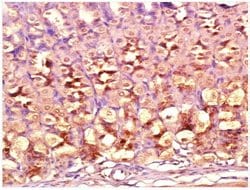 DIO2 Rabbit anti-Human, Polyclonal, Bioss 100 &mu;L; Unconjugated:Antibodies,