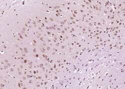 DIO2 Rabbit anti-Human, Polyclonal, Bioss 100 &mu;L; Unconjugated:Antibodies,