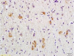 Adenomatous Polyposis Coli Rabbit anti-Human, Polyclonal, Bioss 100 &mu;L;