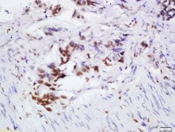 OGG1 Rabbit anti-Human, Polyclonal, Bioss 100 &mu;L; Unconjugated:Antibodies,