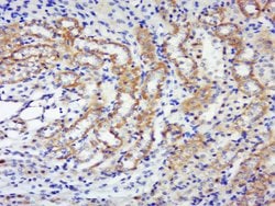 Phospho-p70 S6 Kinase Beta (Thr444, Ser447) Rabbit anti-Human Mouse Rat,