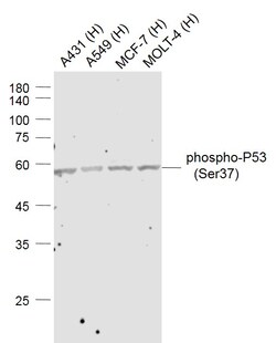 Phospho-P53 (Ser37) Polyclonal Antibody, Bioss 100 &mu;L | Buy Online | Bioss | Fisher Scientific