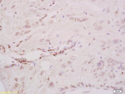 Phospho-CHK2 (Thr68) Rabbit anti-Human, Polyclonal, Bioss 100 &mu;L; Unconjugated:Antibodies,