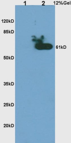 Phospho-CHK2 (Thr68) Rabbit anti-Human, Polyclonal, Bioss 100 &mu;L; Unconjugated:Antibodies,