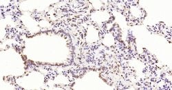 Phospho-PKC delta (Thr505, Thr507) Rabbit anti-Human, Polyclonal, Bioss