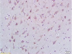 STMN2/SCG10 Rabbit anti-Human, Polyclonal, Bioss 100 &mu;L; Unconjugated:Antibodies,