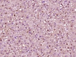 Acetyl-Histone H3 (Lys23) Rabbit anti-Human, Polyclonal, Bioss 100 &mu;L;