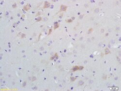 SCD1 Rabbit anti-Human, Polyclonal, Bioss 100 &mu;L; Unconjugated:Antibodies,