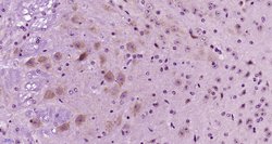 SCD1 Rabbit anti-Human, Polyclonal, Bioss 100 &mu;L; Unconjugated:Antibodies,