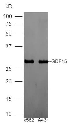 GDF15/MIC-1 Rabbit anti-Human, Polyclonal, Bioss 100 &mu;L; Unconjugated:Antibodies,