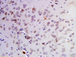 KDM1A Polyclonal Antibody, Bioss 100 &mu;L; Unconjugated:Antibodies, Polyclonal