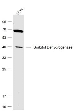 SDH/Sorbitol Dehydrogenase Rabbit anti-Human, Polyclonal, Bioss 100 &mu;L;