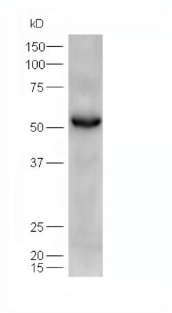ATGL/Adipose Triglyceride Lipase Rabbit anti-Human, Polyclonal, Bioss 100