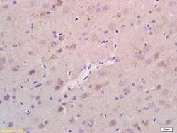 RHEB Rabbit anti-Human, Polyclonal, Bioss 100 &mu;L; Unconjugated:Antibodies,