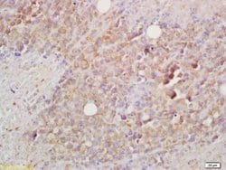 BCMA/CD269 Rabbit anti-Human, Polyclonal, Bioss 100 &mu;L; Unconjugated:Antibodies,