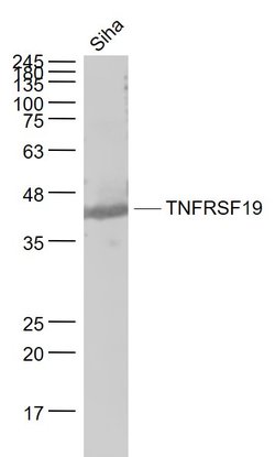 TNFRSF19/TROY Rabbit anti-Human, Polyclonal, Bioss 100 &mu;L; Unconjugated:Antibodies,