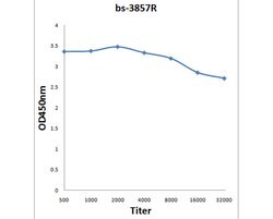 SSDD/Steroid sulfatase Rabbit anti-Human, Polyclonal, Bioss 100 &mu;L;