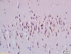 Rab24 Rabbit anti-Human, Polyclonal, Bioss 100 &mu;L; Unconjugated:Antibodies,