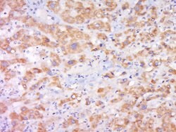 Cytochrome b245 Light Chain Rabbit anti-Human, Polyclonal, Bioss 100 &mu;L;