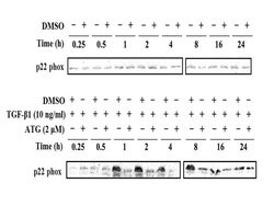 Cytochrome b245 Light Chain Rabbit anti-Human, Polyclonal, Bioss 100 &mu;L;