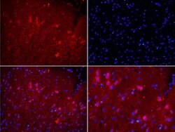 NOX2/gp91phox Rabbit anti-Human, Polyclonal, Bioss 100 &mu;L; Unconjugated:Antibodies,