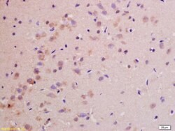 NDUFS1 Rabbit anti-Human, Polyclonal, Bioss 100 &mu;L; Unconjugated:Antibodies,