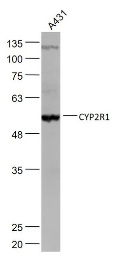 CYP2R1 Rabbit anti-Human, Polyclonal, Bioss 100 &mu;L; Unconjugated:Antibodies,