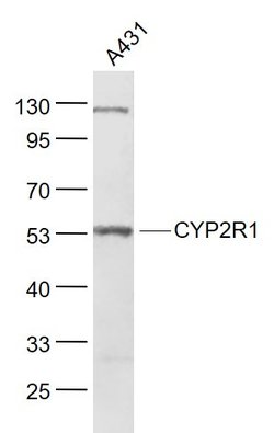 CYP2R1 Rabbit anti-Human, Polyclonal, Bioss 100 &mu;L; Unconjugated:Antibodies,