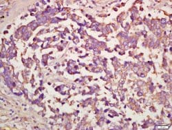 Lrp2/Megalin Rabbit anti-Human, Polyclonal, Bioss 100 &mu;L; Unconjugated:Antibodies,