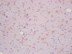 SLCO2B1/OATPB Rabbit anti-Human, Polyclonal, Bioss 100 &mu;L; Unconjugated:Antibodies,
