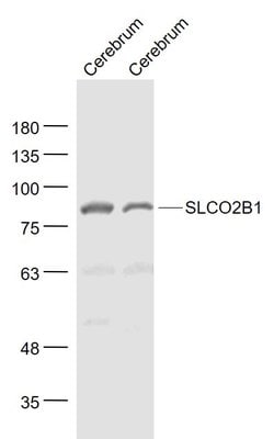SLCO2B1/OATPB Rabbit anti-Human, Polyclonal, Bioss 100 &mu;L; Unconjugated:Antibodies,