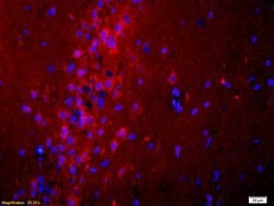 ADCY10 Rabbit anti-Human, Polyclonal, Bioss 100 &mu;L; Unconjugated:Antibodies,