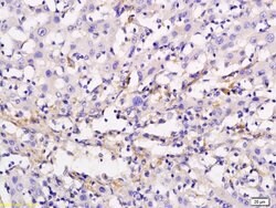 ADCY10 Rabbit anti-Human, Polyclonal, Bioss 100 &mu;L; Unconjugated:Antibodies,
