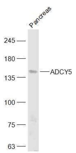 ADCY5 Rabbit anti-Human, Polyclonal, Bioss 100 &mu;L; Unconjugated:Antibodies,