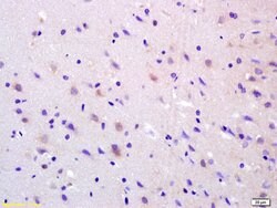 ADCY8 Rabbit anti-Human, Polyclonal, Bioss 100 &mu;L; Unconjugated:Antibodies,