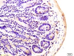 ADCY8 Rabbit anti-Human, Polyclonal, Bioss 100 &mu;L; Unconjugated:Antibodies,