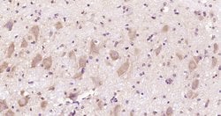 CACNA1A/Cav2.1 Rabbit anti-Human, Polyclonal, Bioss 100 &mu;L; Unconjugated:Antibodies,