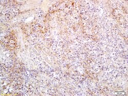 SLC27A2/ACSVL1 Rabbit anti-Human, Polyclonal, Bioss 100 &mu;L; Unconjugated:Antibodies,