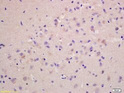 G protein alpha S Rabbit anti-Human, Polyclonal, Bioss 100 &mu;L; Unconjugated:Antibodies,