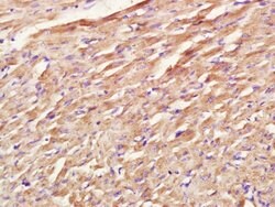 COX1/MTCO1 Rabbit anti-Human, Polyclonal, Bioss 100 &mu;L; Unconjugated:Antibodies,