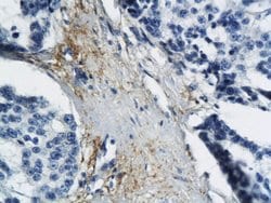 MT-ND6 Rabbit anti-Human, Polyclonal, Bioss 100 &mu;L; Unconjugated:Antibodies,