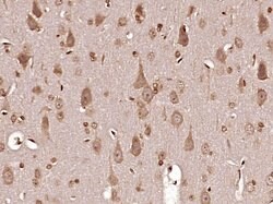 MT-ND6 Rabbit anti-Human, Polyclonal, Bioss 100 &mu;L; Unconjugated:Antibodies,