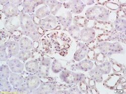 HK/Hexokinase 1 Rabbit anti-Human, Polyclonal, Bioss 100 &mu;L; Unconjugated:Antibodies,