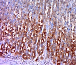 HK/Hexokinase 1 Rabbit anti-Human, Polyclonal, Bioss 100 &mu;L; Unconjugated:Antibodies,