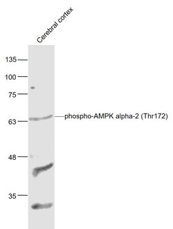 Phospho-AMPK alpha-1/2 (Thr172, Thr183) Rabbit anti-Human, Polyclonal, Bioss 100 &mu;L | Buy Online | Bioss | Fisher Scientific