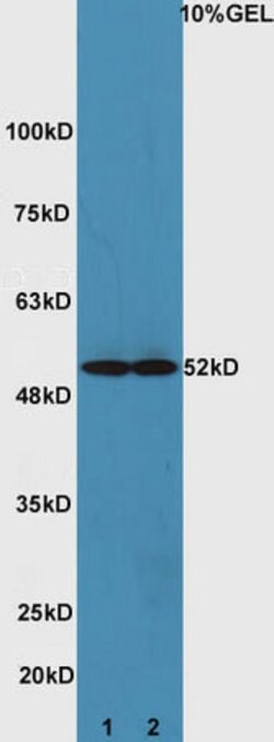 ATG4D Rabbit anti-Human, Polyclonal, Bioss 100 &mu;L; Unconjugated:Antibodies,
