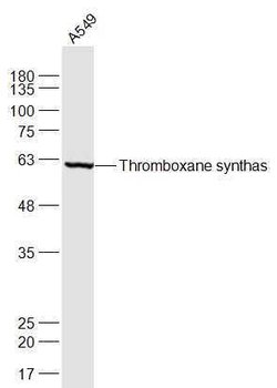 Thromboxane synthase Rabbit anti-Human, Polyclonal, Bioss 100 &mu;L; Unconjugated:Antibodies,