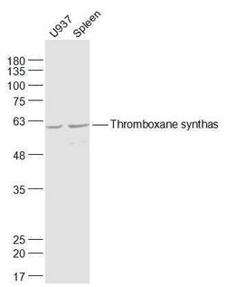 Thromboxane synthase Rabbit anti-Human, Polyclonal, Bioss 100 &mu;L; Unconjugated:Antibodies,
