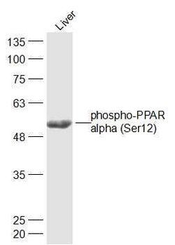 Phospho-PPAR alpha (Ser12) Rabbit anti-Human, Polyclonal, Bioss 100 &mu;L;